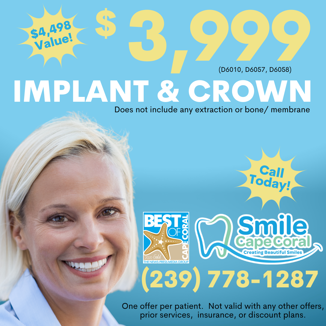 $3999 Implant & Crown special
