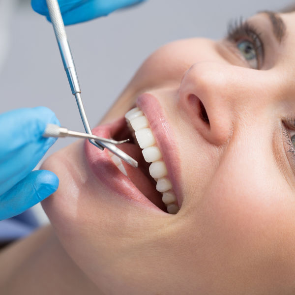 Dental Cleanings in Cape Coral Florida