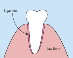 Tooth extraction diagram